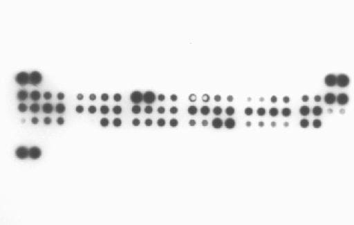 Proteome Profiler Human Apoptosis Array Kit ARY009