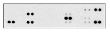 Proteome Profiler Human Apoptosis Array Kit ARY009