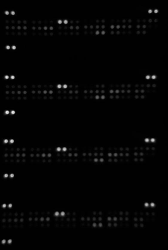 Proteome Profiler Human Apoptosis Array Kit ARY009