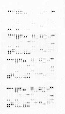 Proteome Profiler Human XL Cytokine Array Kit ARY022B