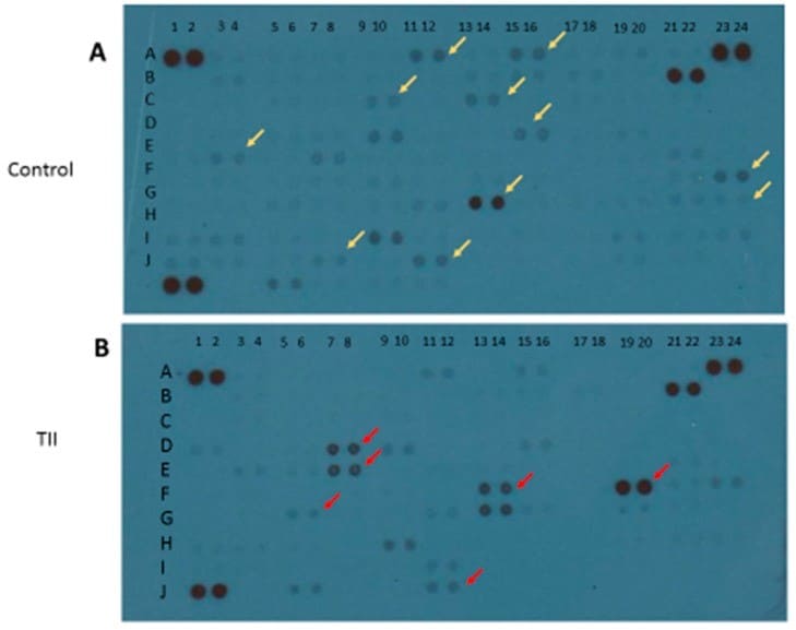 Proteome Profiler Human XL Cytokine Array Kit ARY022B