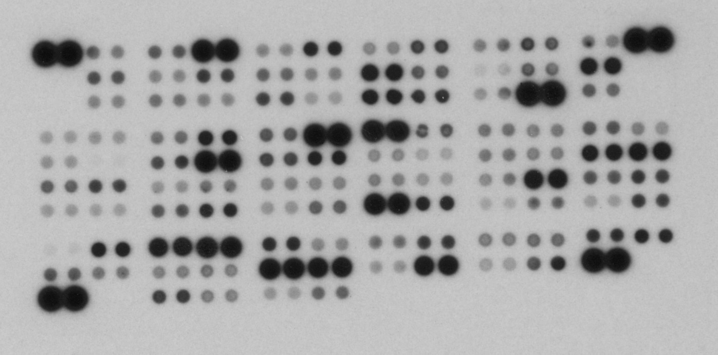 Proteome Profiler Human XL Cytokine Array Kit ARY022B