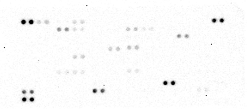 Proteome Profiler Human XL Cytokine Array Kit ARY022B