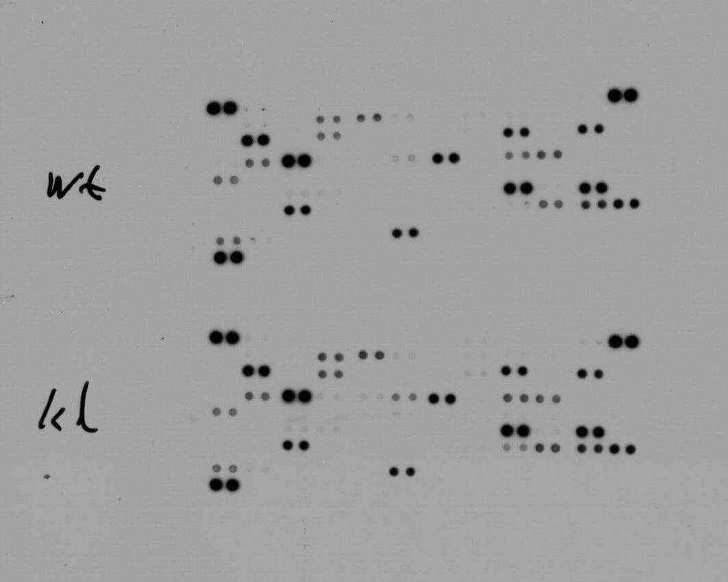 Proteome Profiler Human XL Oncology Array ARY026