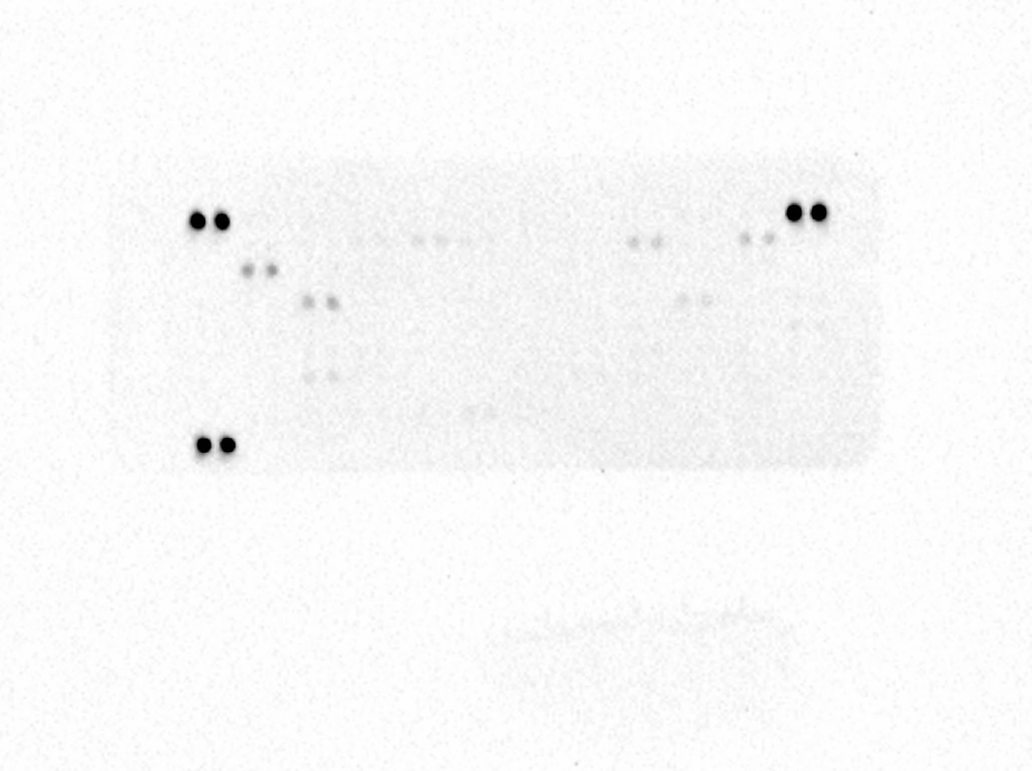 Proteome Profiler Human XL Oncology Array ARY026