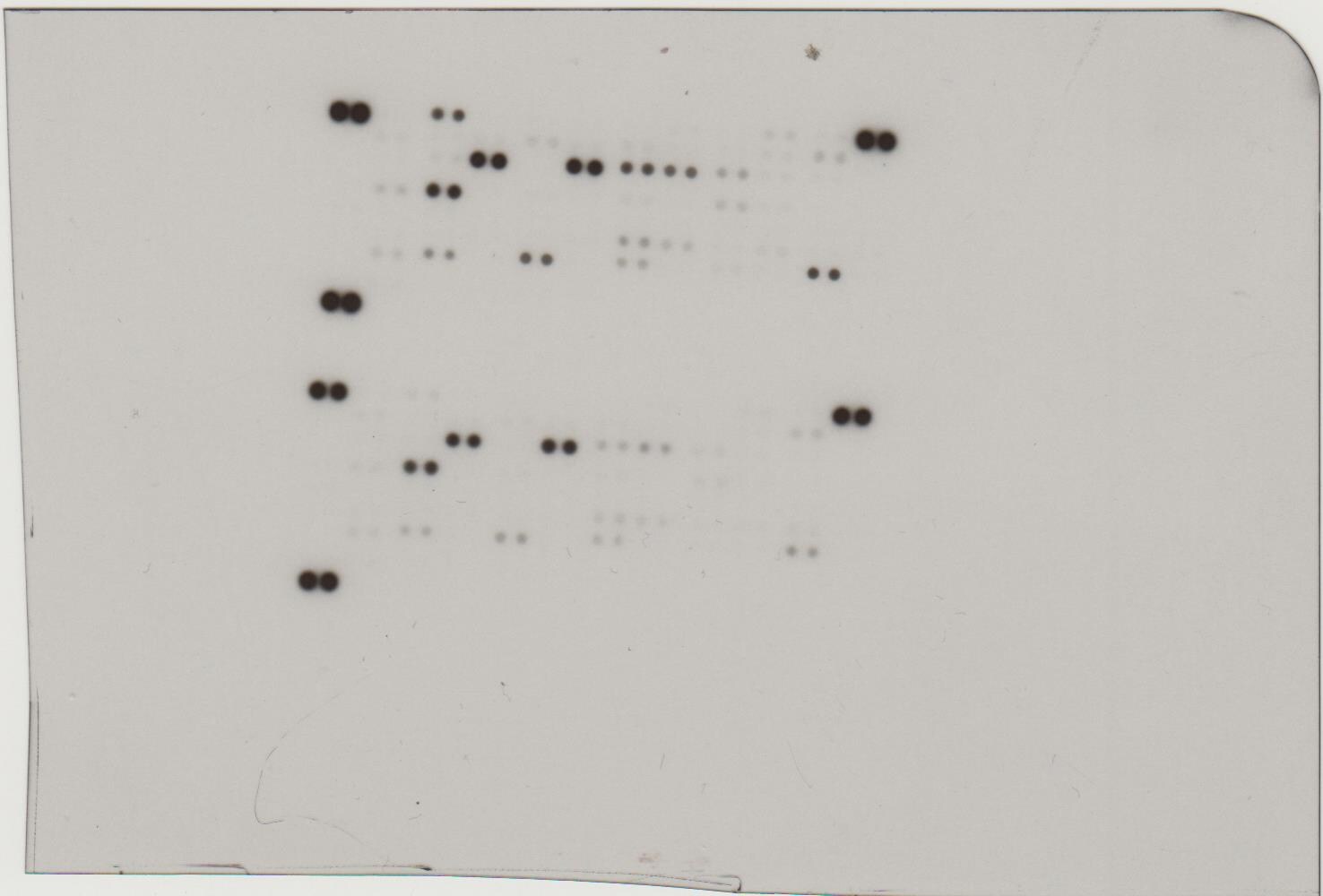 Proteome Profiler Human XL Oncology Array ARY026