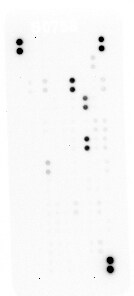 Proteome Profiler Human XL Oncology Array ARY026