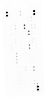 Proteome Profiler Human XL Oncology Array ARY026