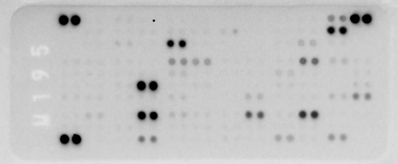 Proteome Profiler Mouse XL Cytokine Array ARY028