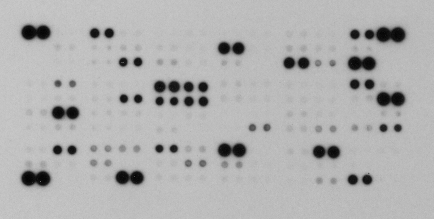 Proteome Profiler Mouse XL Cytokine Array ARY028