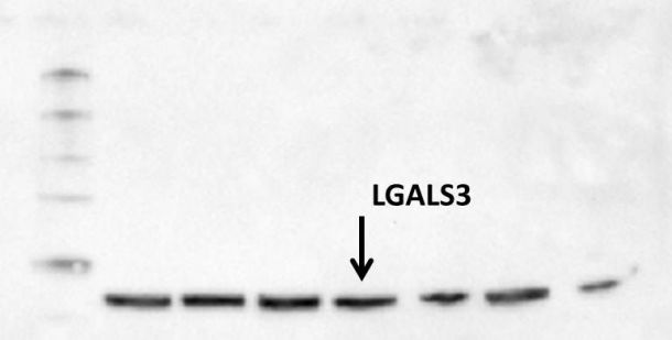 Human Galectin‑3 Biotinylated Antibody BAF1154