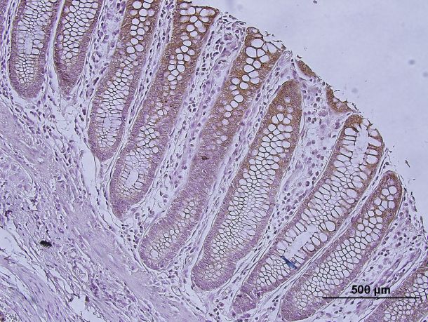 Human Galectin‑3 Biotinylated Antibody BAF1154