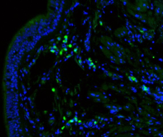 Human IL‑17E/IL‑25 Biotinylated Antibody BAF1258