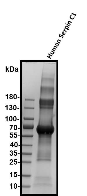 Human Serpin C1/Antithrombin-III Biotinylated Antibody BAF1267
