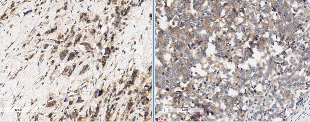 Human MICA Biotinylated Antibody BAF1300