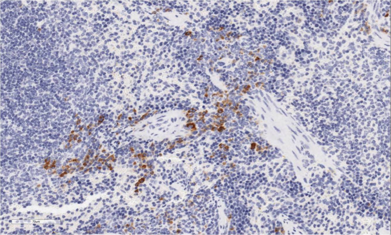 Mouse NKp46/NCR1 Biotinylated Antibody BAF2225