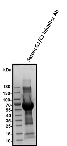 Human Serpin G1/C1 Inhibitor Biotinylated Antibody BAF2488
