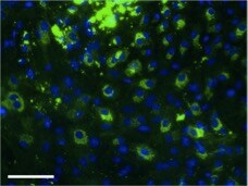 Mouse Osteopontin/OPN Biotinylated Antibody BAF808