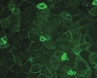 Human CD44s Pan Specific Antibody BBA10