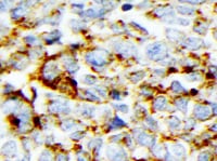 Human CD44s Pan Specific Antibody BBA10