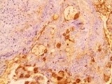 Human E‑Selectin/CD62E Antibody BBA16