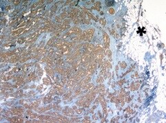 Human E‑Selectin/CD62E Antibody BBA16