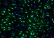 Human E‑Selectin/CD62E Antibody BBA16