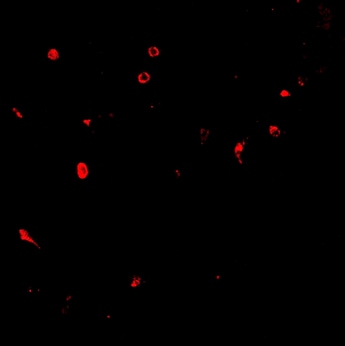 Human E‑Selectin/CD62E Antibody BBA18