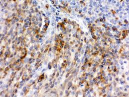Human E‑Selectin/P‑Selectin (CD62E/P) Antibody BBA1