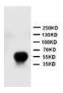 Human E‑Selectin/P‑Selectin (CD62E/P) Antibody BBA1