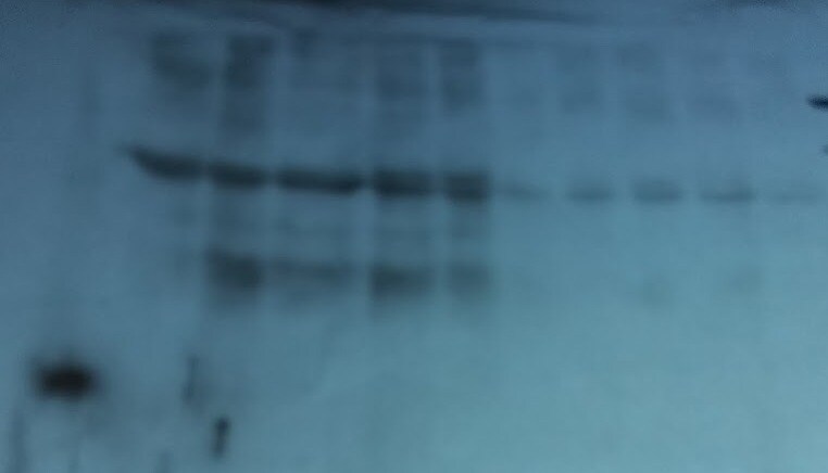 Human E‑Selectin/P‑Selectin (CD62E/P) Antibody BBA1