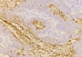 Human E‑Selectin/P‑Selectin (CD62E/P) Antibody BBA1