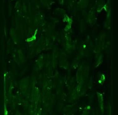 Human ICAM‑1/CD54 Antibody BBA3