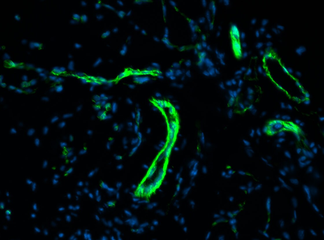 Human CD31/PECAM‑1 Antibody BBA7