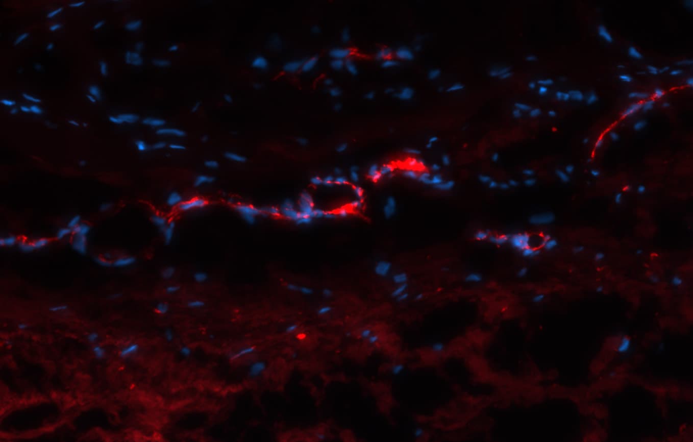 Human CD31/PECAM‑1 Antibody BBA7
