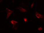 Human E‑Selectin/CD62E Biotinylated Antibody BBA8