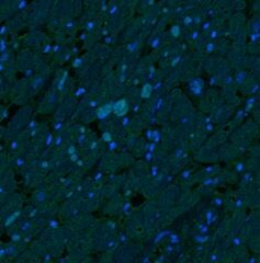 PINK1 Antibody - BSA Free BC100-494