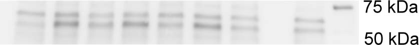 PINK1 Antibody - BSA Free BC100-494