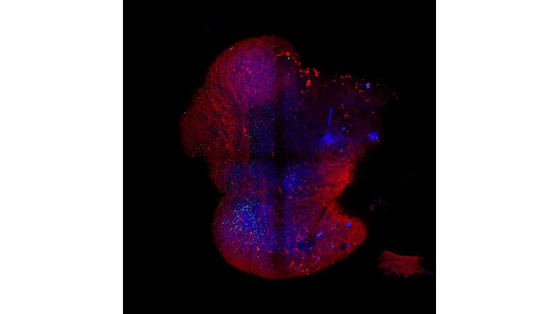 Recombinant Human IL-2 Protein, Animal-Free BT-002-AFL