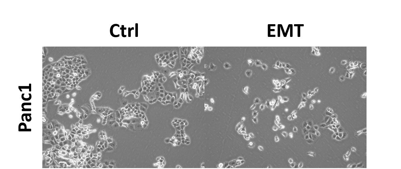 StemXVivo EMT Inducing Media Supplement (100X) CCM017