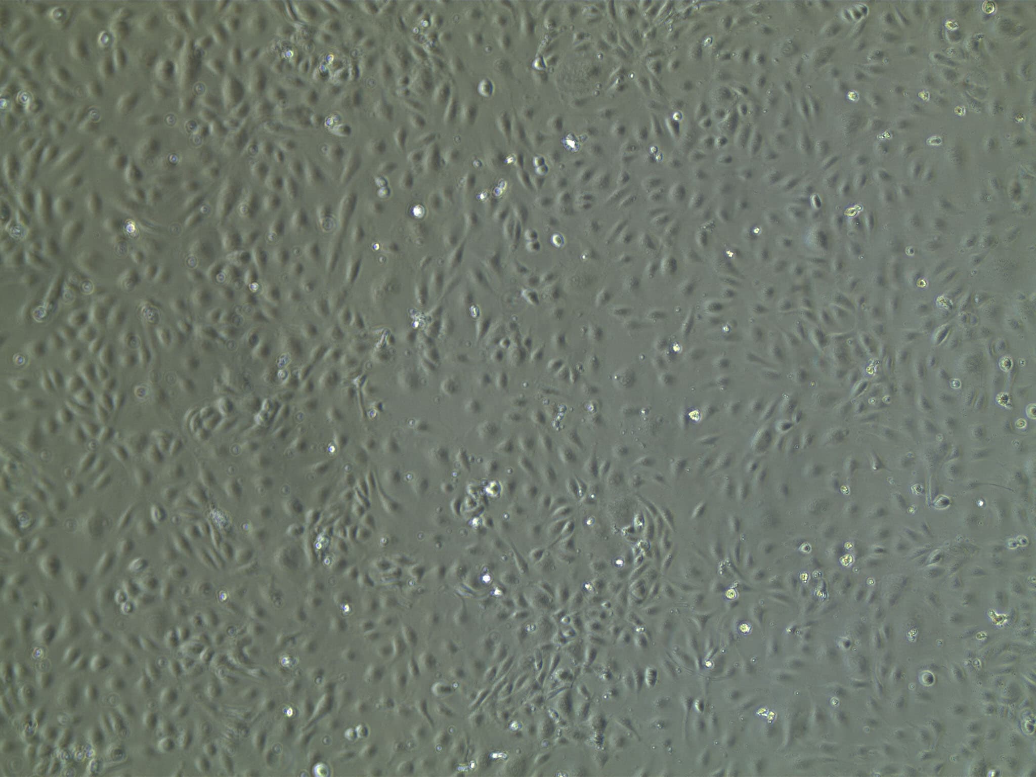 Endothelial Cell Growth Media CCM027