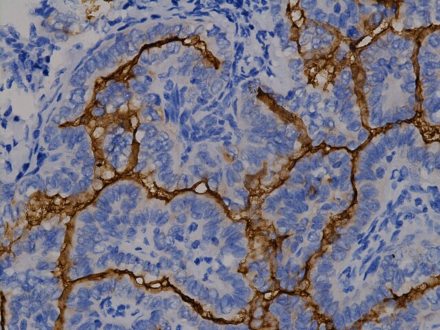 Anti-Rat HRP-DAB Cell & Tissue Staining Kit CTS017