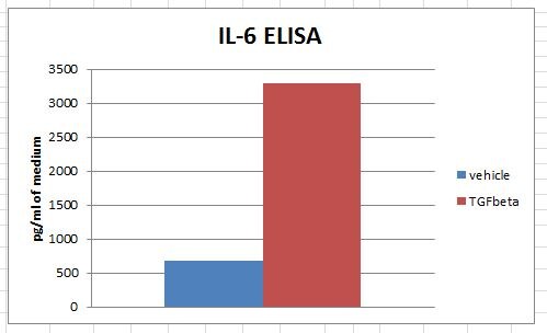 Human IL-6 Quantikine ELISA Kit D6050