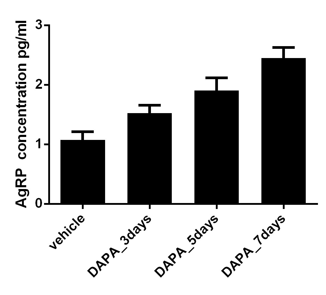 Human AgRP Quantikine ELISA Kit DAGR00