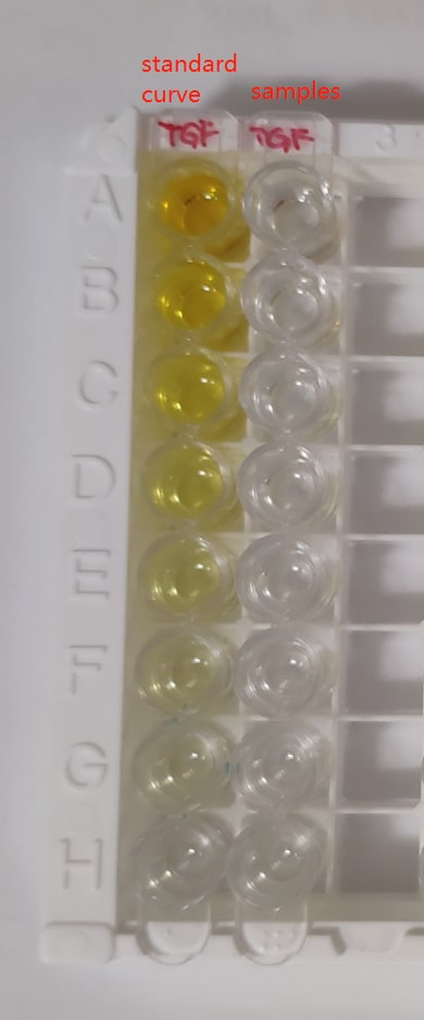 Human/Mouse/Rat/Porcine/Canine TGF-beta 1 Quantikine ELISA DB100C