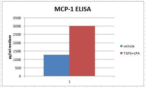Human CCL2/MCP-1 Quantikine ELISA Kit DCP00