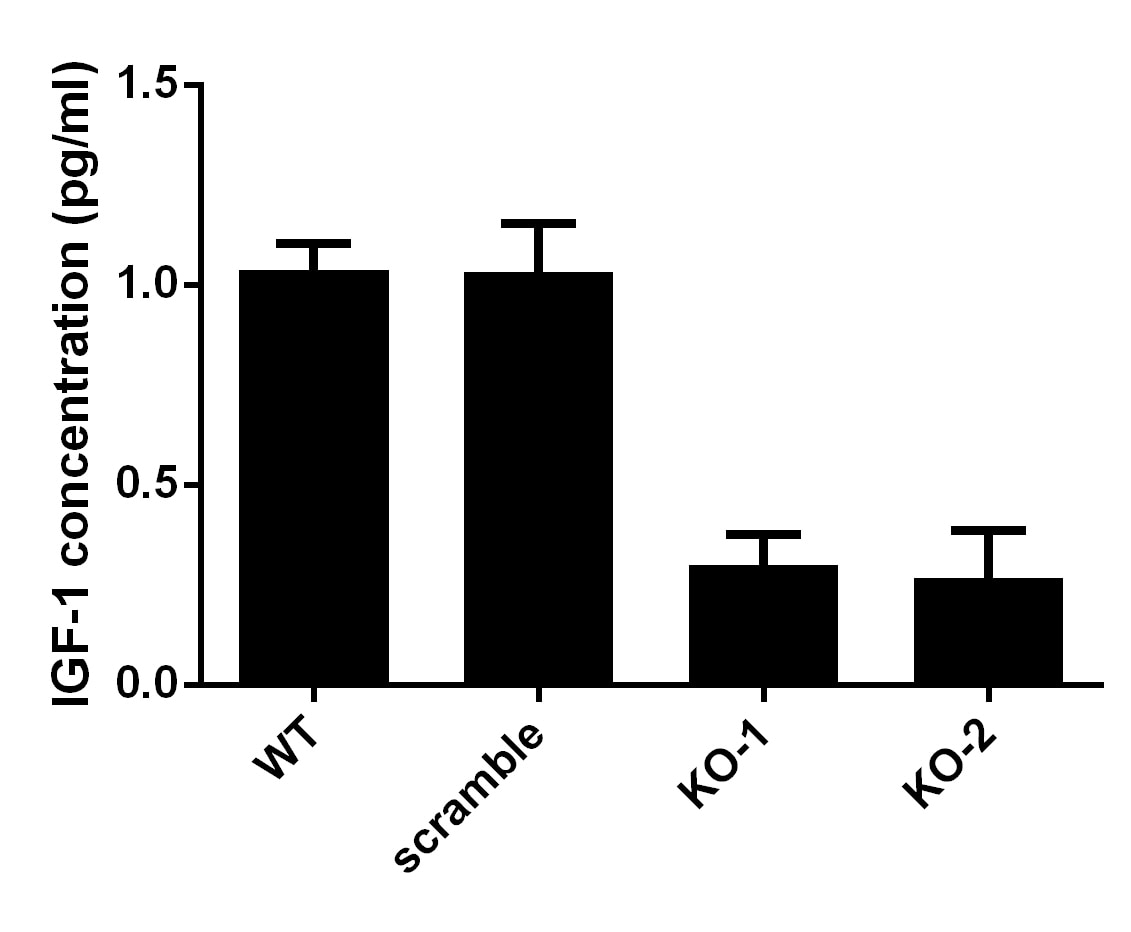 Human IGF-I/IGF-1 Quantikine ELISA Kit DG100B