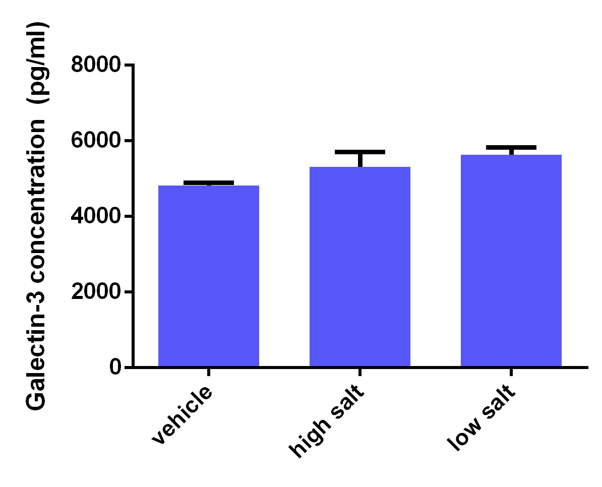 Human Galectin-3 Quantikine ELISA Kit DGAL30