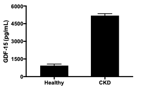Human GDF-15 Quantikine ELISA Kit DGD150