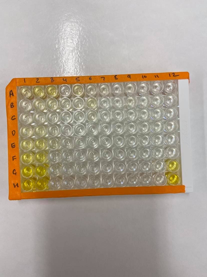 Human IFN-gamma Quantikine ELISA Kit DIF50C